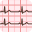 ECG Guide 6.1